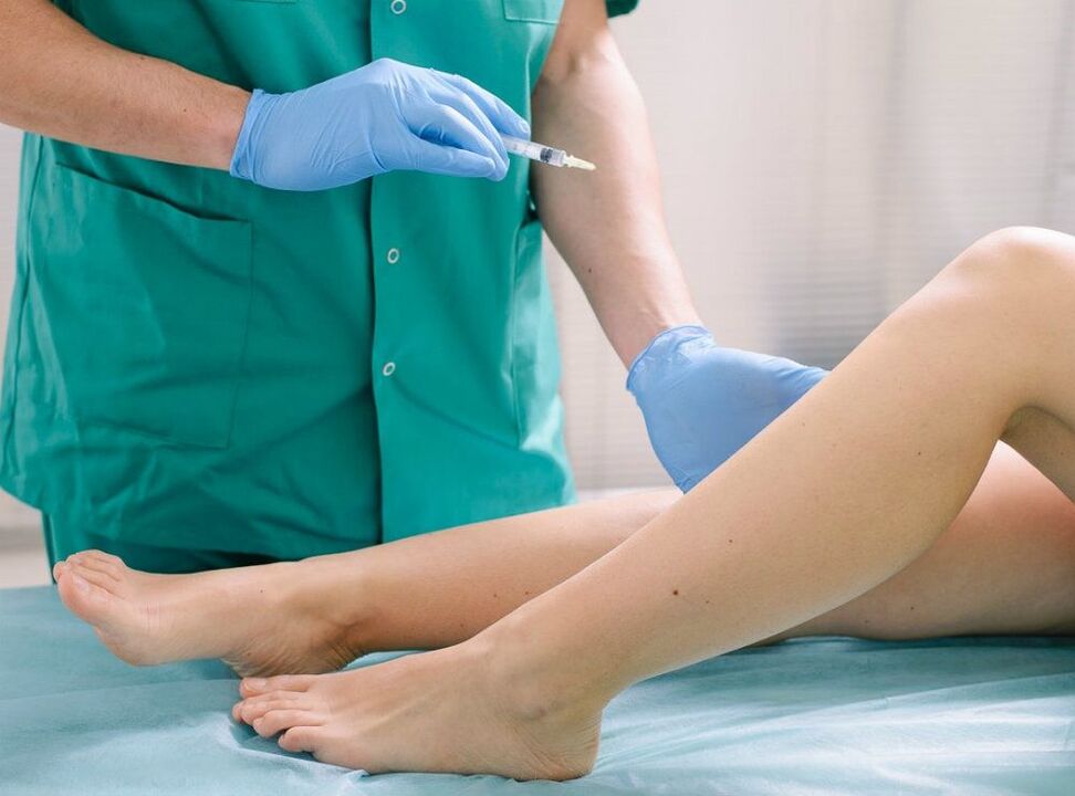 Chirurgie pour enlever les varices