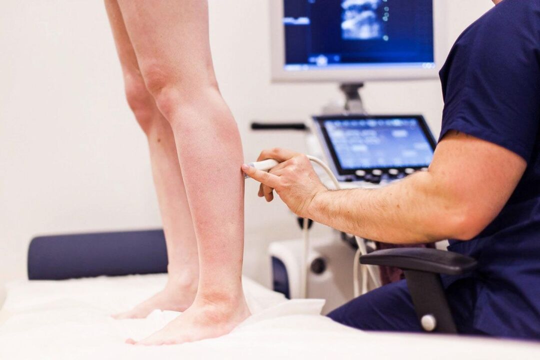 Avant de traiter les varices des jambes, un diagnostic par échographie est nécessaire. 